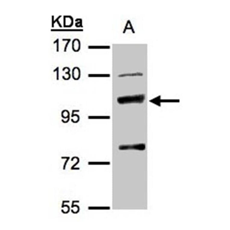 MANBA antibody from Signalway Antibody (22166) - Antibodies.com