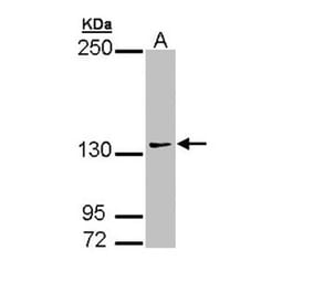 AUTS2 antibody from Signalway Antibody (22200) - Antibodies.com