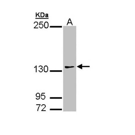AUTS2 antibody from Signalway Antibody (22200) - Antibodies.com