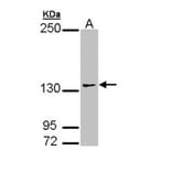 AUTS2 antibody from Signalway Antibody (22200) - Antibodies.com
