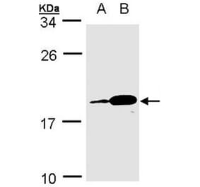 PACAP antibody from Signalway Antibody (22227) - Antibodies.com