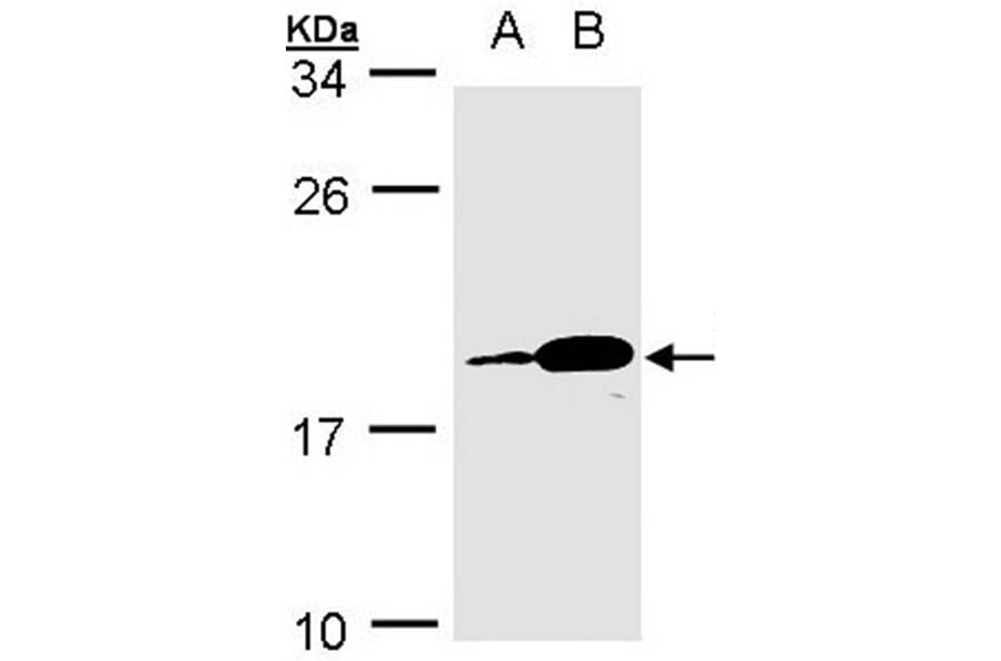 PACAP antibody from Signalway Antibody (22227) - Antibodies.com