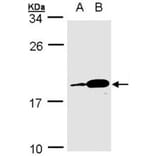 PACAP antibody from Signalway Antibody (22227) - Antibodies.com