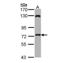 EXOC7 antibody from Signalway Antibody (22233) - Antibodies.com