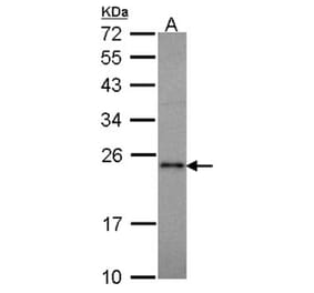 RAP1A antibody from Signalway Antibody (22245) - Antibodies.com
