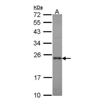 RAP1A antibody from Signalway Antibody (22245) - Antibodies.com