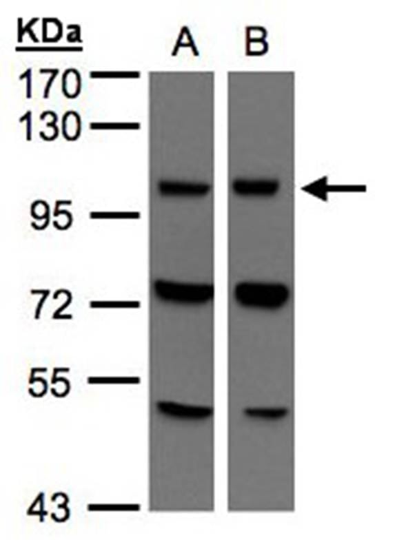 Sample (30 µg of whole cell lysate) 293TB: Hep G27.5% SDS PAGE Primary antibody diluted at 1: 500