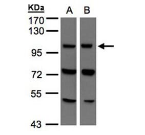 VPS11 antibody from Signalway Antibody (22313) - Antibodies.com