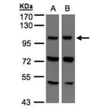 VPS11 antibody from Signalway Antibody (22313) - Antibodies.com