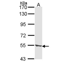 CLN2 antibody from Signalway Antibody (22319) - Antibodies.com