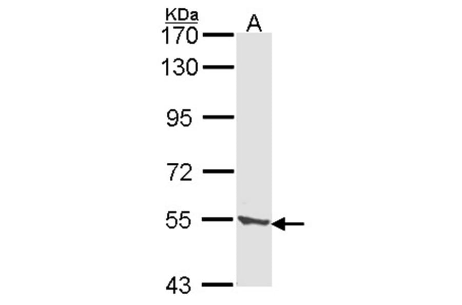 CLN2 antibody from Signalway Antibody (22319) - Antibodies.com
