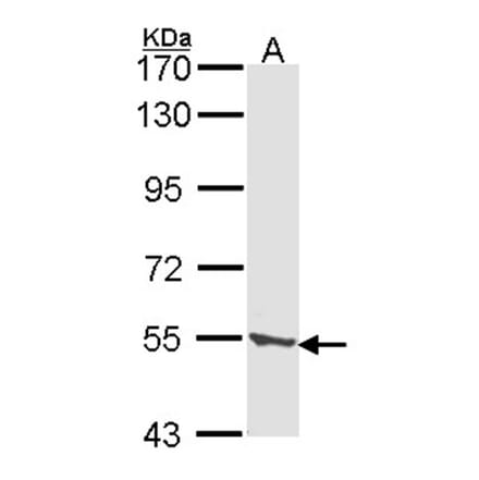 CLN2 antibody from Signalway Antibody (22319) - Antibodies.com