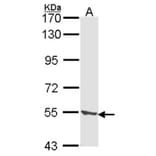CLN2 antibody from Signalway Antibody (22319) - Antibodies.com