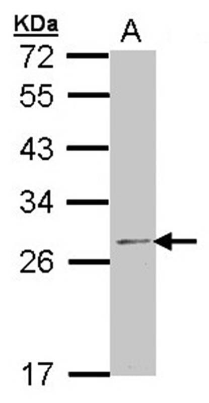 Anti-RPL14 Antibody (A42645) | Antibodies.com