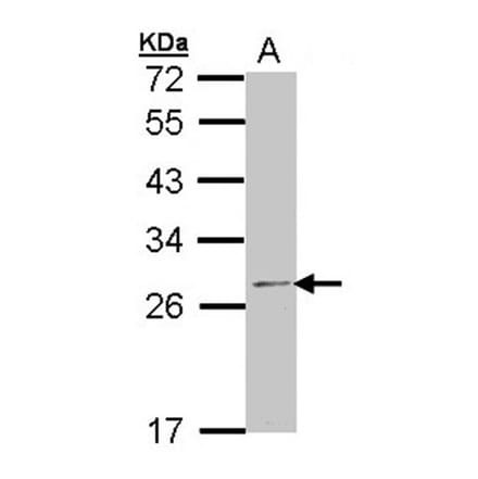 RPL14 antibody from Signalway Antibody (22339) - Antibodies.com