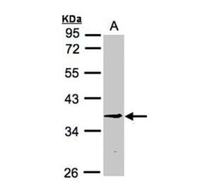 BXDC1 antibody from Signalway Antibody (22367) - Antibodies.com