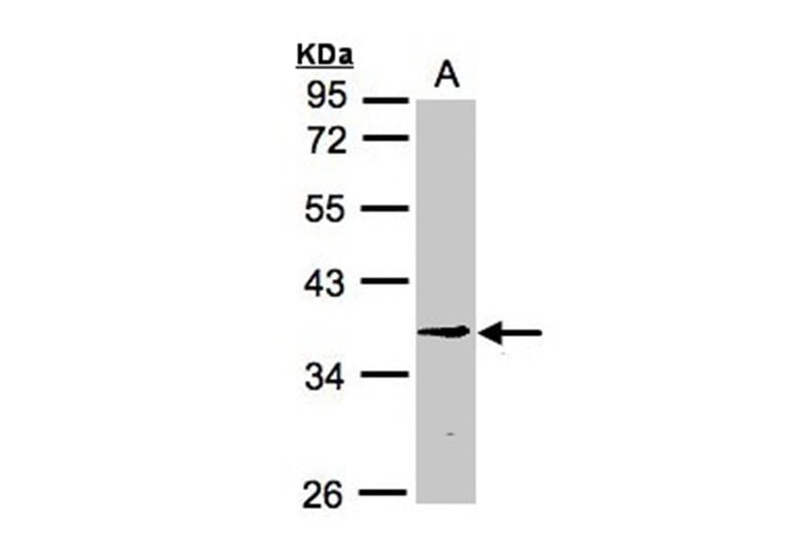 BXDC1 antibody from Signalway Antibody (22367) - Antibodies.com