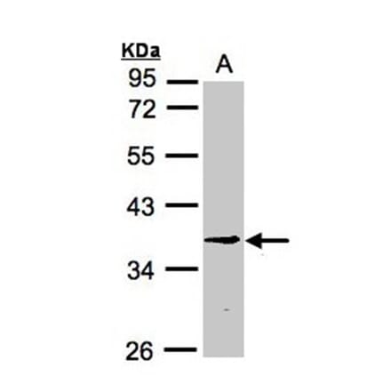 BXDC1 antibody from Signalway Antibody (22367) - Antibodies.com