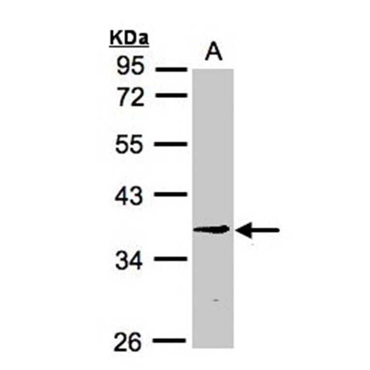 BXDC1 antibody from Signalway Antibody (22367) - Antibodies.com