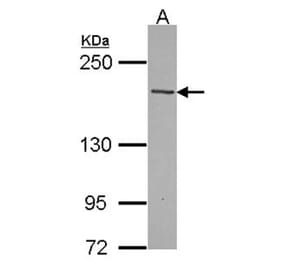 TENC1 antibody from Signalway Antibody (22371) - Antibodies.com