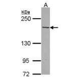 TENC1 antibody from Signalway Antibody (22371) - Antibodies.com