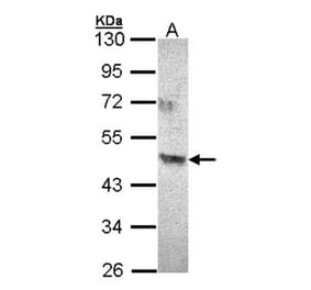 ACAD8 antibody from Signalway Antibody (22378) - Antibodies.com