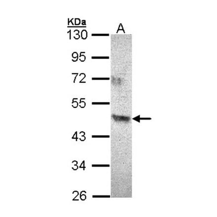 ACAD8 antibody from Signalway Antibody (22378) - Antibodies.com