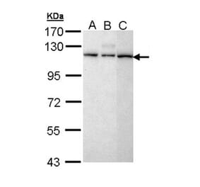 SART1 antibody from Signalway Antibody (22397) - Antibodies.com