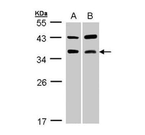 TRAP antibody from Signalway Antibody (22406) - Antibodies.com