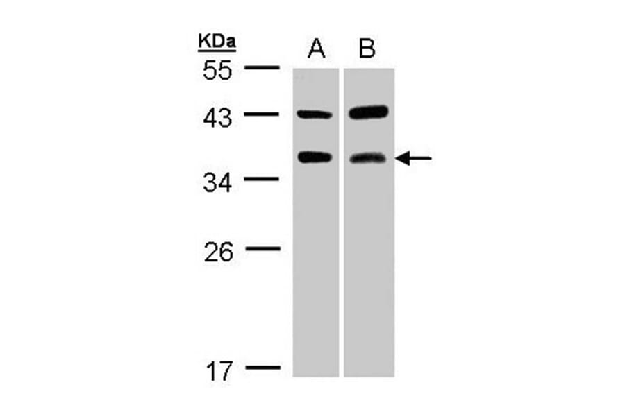 TRAP antibody from Signalway Antibody (22406) - Antibodies.com