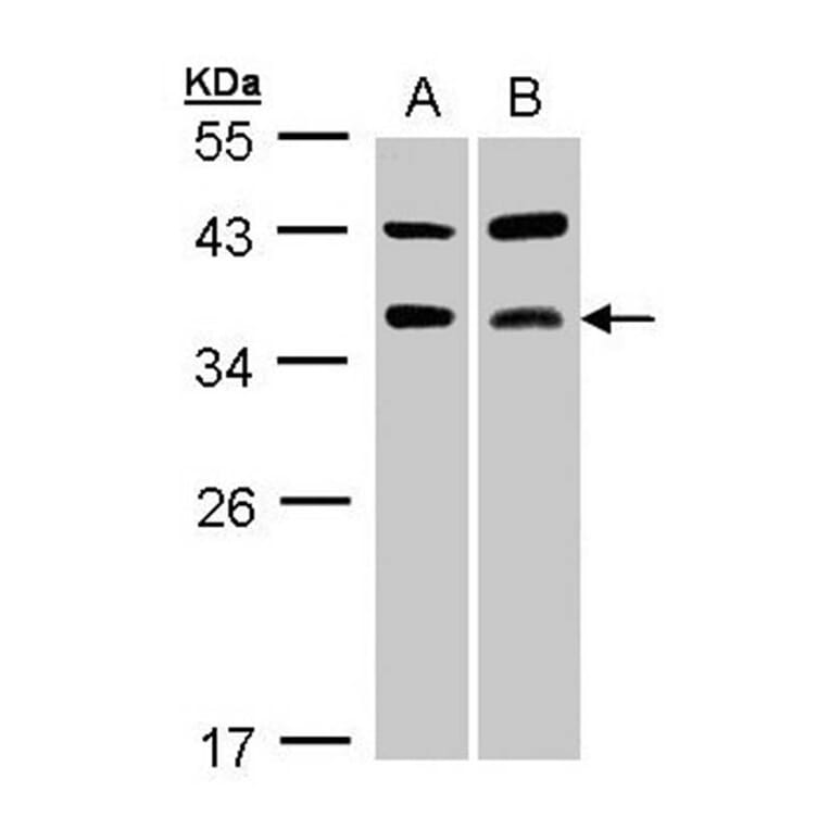 TRAP antibody from Signalway Antibody (22406) - Antibodies.com