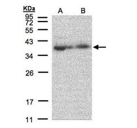 MRPL3 antibody from Signalway Antibody (22418) - Antibodies.com