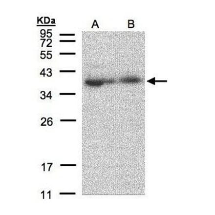 MRPL3 antibody from Signalway Antibody (22418) - Antibodies.com