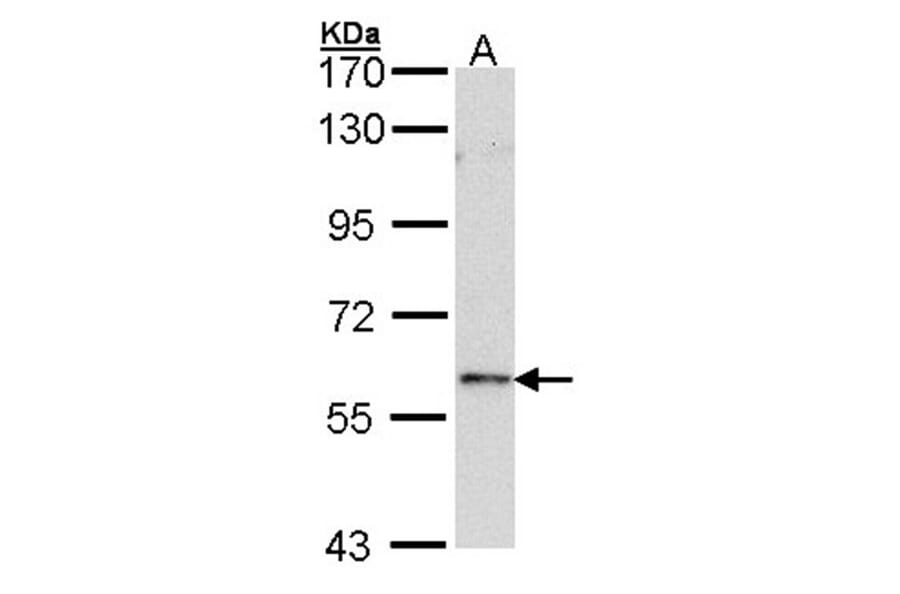 FOXN1 antibody from Signalway Antibody (22433) - Antibodies.com