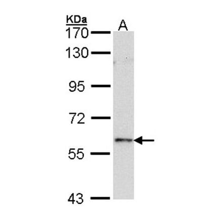 FOXN1 antibody from Signalway Antibody (22433) - Antibodies.com