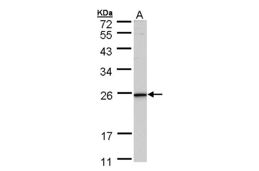 KLRG1 antibody from Signalway Antibody (22436) - Antibodies.com