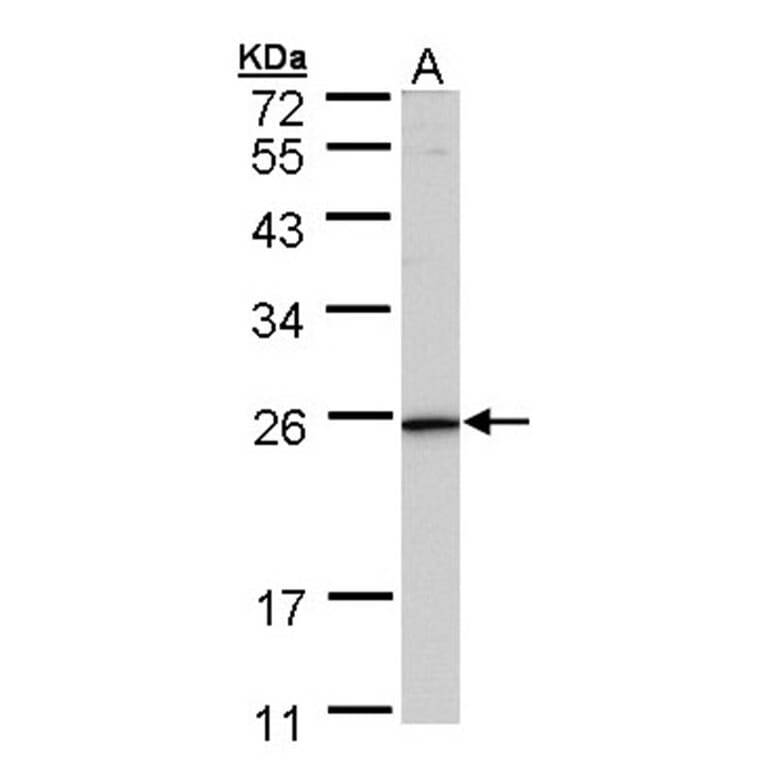 KLRG1 antibody from Signalway Antibody (22436) - Antibodies.com