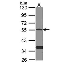 SMAD9 antibody from Signalway Antibody (22461) - Antibodies.com