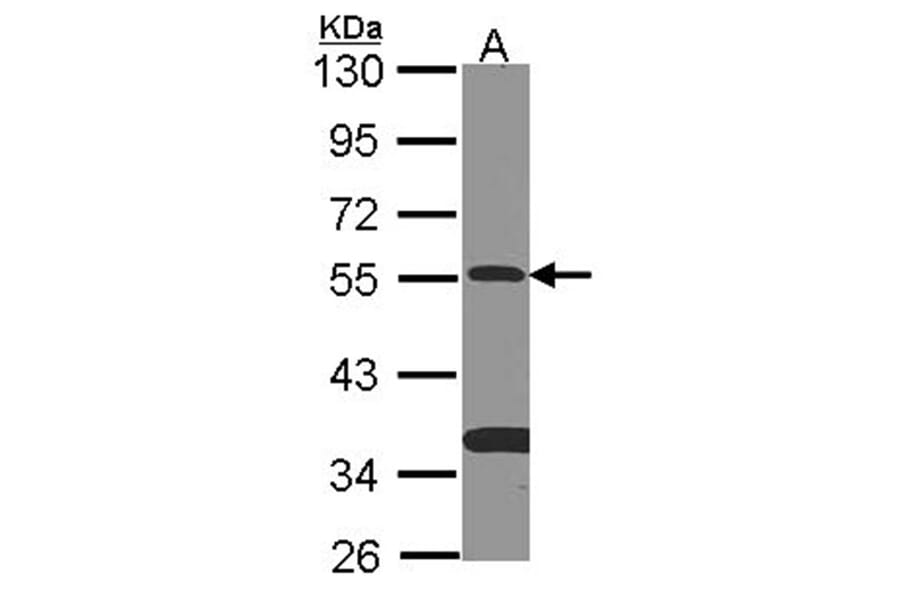 SMAD9 antibody from Signalway Antibody (22461) - Antibodies.com
