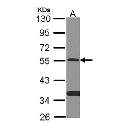 SMAD9 antibody from Signalway Antibody (22461) - Antibodies.com