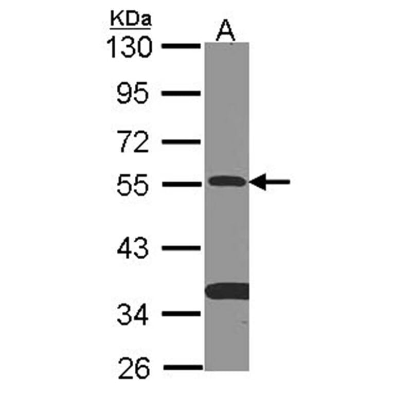 SMAD9 antibody from Signalway Antibody (22461) - Antibodies.com