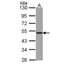 HADHB antibody from Signalway Antibody (22469) - Antibodies.com
