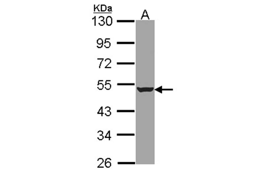 HADHB antibody from Signalway Antibody (22469) - Antibodies.com