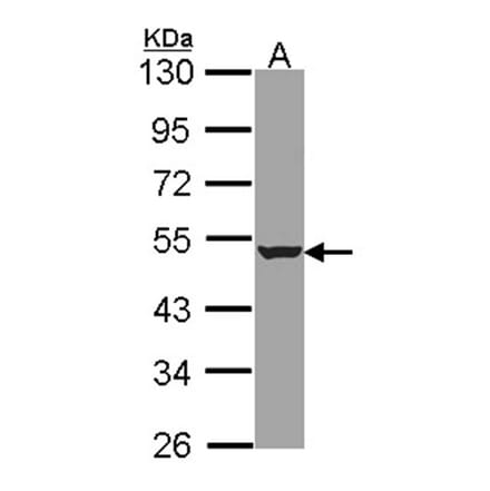 HADHB antibody from Signalway Antibody (22469) - Antibodies.com