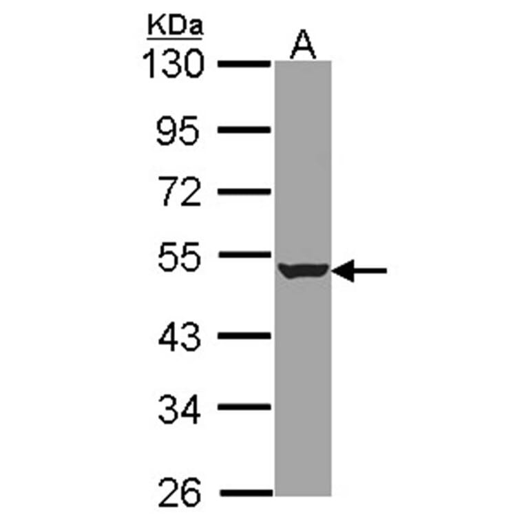 HADHB antibody from Signalway Antibody (22469) - Antibodies.com