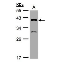 GIPC3 antibody from Signalway Antibody (22474) - Antibodies.com