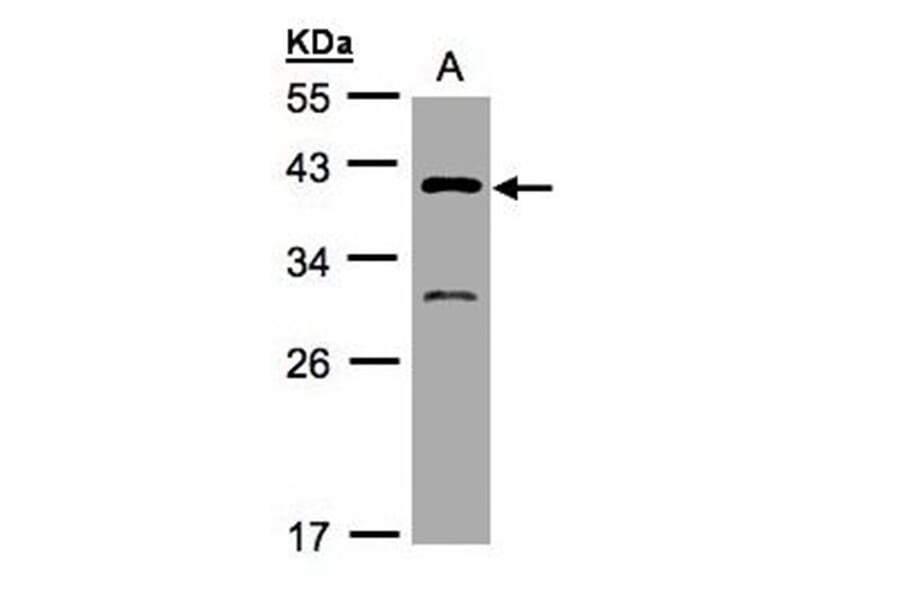 GIPC3 antibody from Signalway Antibody (22474) - Antibodies.com