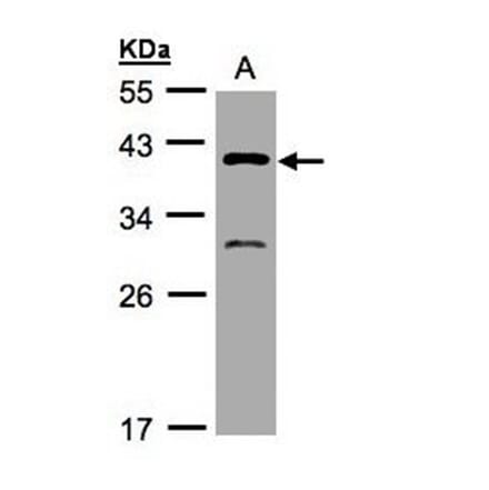 GIPC3 antibody from Signalway Antibody (22474) - Antibodies.com