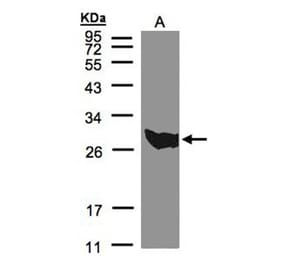 PGAM1 antibody from Signalway Antibody (22489) - Antibodies.com