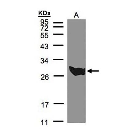 PGAM1 antibody from Signalway Antibody (22489) - Antibodies.com